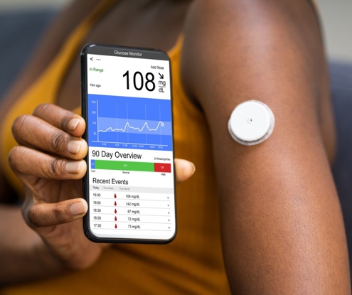 Continuous Glucose Monitor Support Group